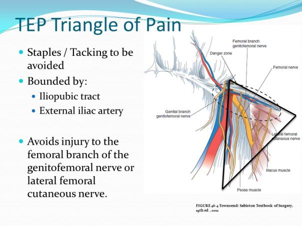 triangle of pain boundaries