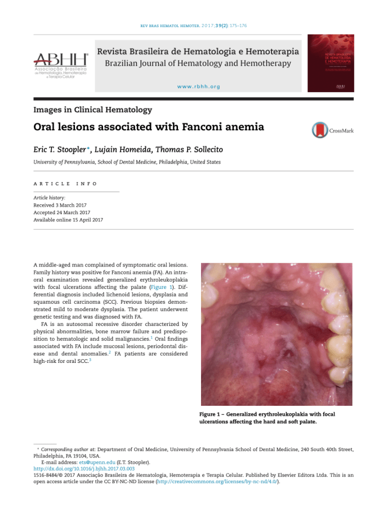 Dental association with fanconi syndrome