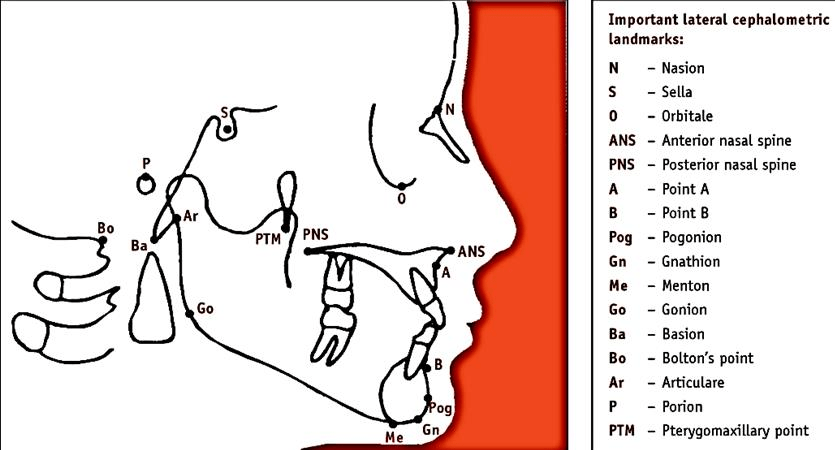 Cephalometric landmarks