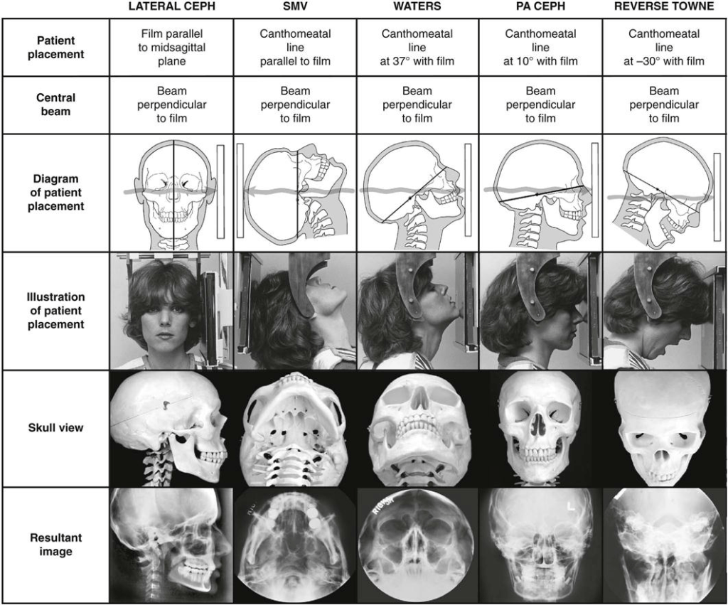 Extraoral radiographs